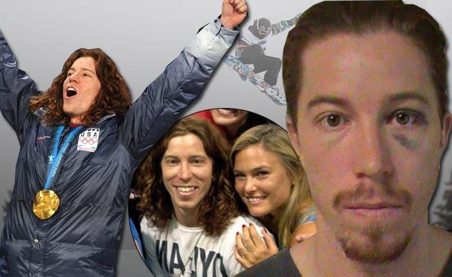 shaun white 0918