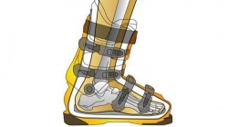 bootfoot